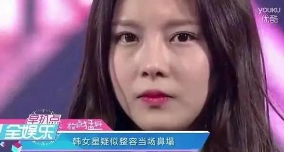 韩星任娜英鼻子塌陷后来呢 任娜英整容失败鼻子一捏居然塌了动图
